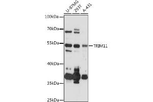 Western blot analysis of extracts of various cell lines, using TRIM11 antibody (ABIN6132732, ABIN6149500, ABIN6149501 and ABIN6218047) at 1:3000 dilution. (TRIM11 anticorps  (AA 267-468))