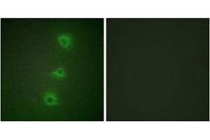 Immunofluorescence analysis of HUVEC cells, using B-RAF antibody.