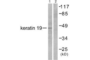 Western blot analysis of extracts from LOVO cells, using Keratin 19 antibody (ABIN5976439). (Cytokeratin 19 anticorps  (Internal Region))
