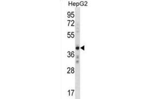 Western Blotting (WB) image for anti-AE Binding Protein 2 (AEBP2) antibody (ABIN3000396) (AEBP2 anticorps)