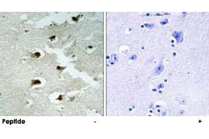 Immunohistochemistry analysis of paraffin-embedded human brain tissue using CDCA4 polyclonal antibody . (CDCA4 anticorps)