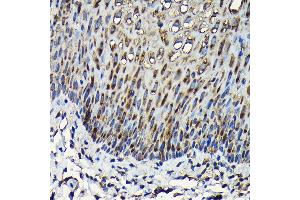 Immunohistochemistry of paraffin-embedded human esophageal using RPL23A Rabbit pAb (ABIN1682576, ABIN3018519, ABIN3018520 and ABIN6220494) at dilution of 1:100 (40x lens).