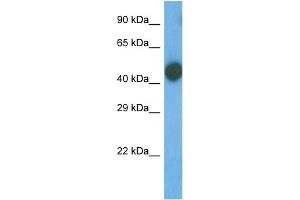 Host:  Rabbit  Target Name:  TRI58  Sample Type:  MCF7 Whole Cell  Antibody Dilution:  1. (TRIM58 anticorps  (N-Term))
