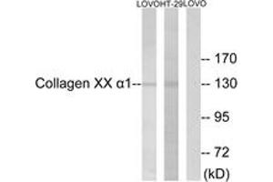 Western Blotting (WB) image for anti-Collagen, Type XX, alpha 1 (COL20A1) (AA 1151-1200) antibody (ABIN2889927)