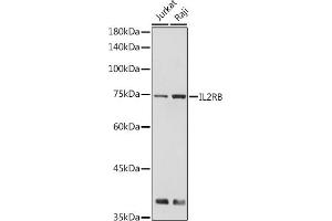 Western blot analysis of extracts of various cell lines, using IL2RB antibody (ABIN6127567, ABIN6142376, ABIN6142377 and ABIN6221796) at 1:500 dilution.