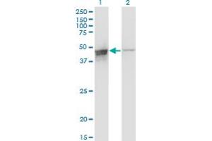 Western Blot analysis of DAZAP1 expression in transfected 293T cell line by DAZAP1 monoclonal antibody (M03), clone 2F6. (DAZAP1 anticorps  (AA 308-407))