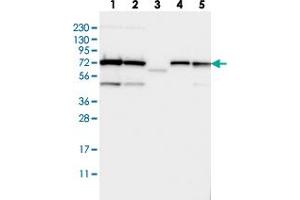 Western blot analysis of Lane 1: RT-4, Lane 2: U-251 MG, Lane 3: Human Plasma, Lane 4: Liver, Lane 5: Tonsil with TRIOBP polyclonal antibody  at 1:250-1:500 dilution. (TRIOBP anticorps)