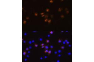 Immunofluorescence analysis of L929 cells using SW antibody (ABIN7270654) at dilution of 1:100. (SWAP70 anticorps  (AA 316-585))