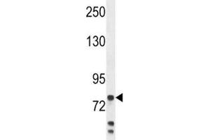 Anti-Myeloperoxidase antibody western blot analysis in MDA-MB231 lysate.