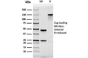 SDS-PAGE Analysis Purified Calbindin 1 Mouse Monoclonal Antibody (CALB1/2364). (CALB1 anticorps  (AA 7-96))