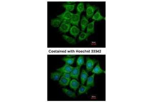 ICC/IF Image Immunofluorescence analysis of methanol-fixed Hep3B, using UBE4B, antibody at 1:500 dilution.