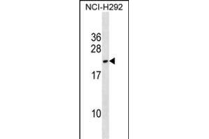 DYDC2 anticorps  (C-Term)