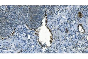 IHC analysis of IDH2 using anti-IDH2 antibody (ABIN7602786). (IDH2 anticorps  (C-Term))