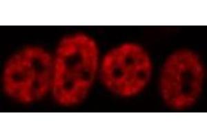 ABIN6266456 staining HeLa  cells by IF/ICC. (HNRNPD/AUF1 anticorps  (pSer83))