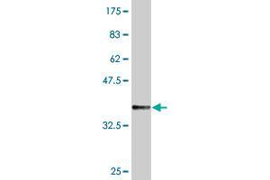 Western Blot detection against Immunogen (36.