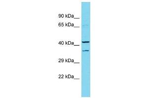 Host:  Rabbit  Target Name:  Dmbx1  Sample Type:  Rat Pancreas lysates  Antibody Dilution:  1. (DMBX1 anticorps  (Middle Region))