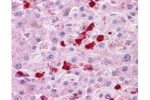 Immunohistochemistry (IHC) image for anti-Leucine Rich Repeat Containing 8 Family, Member B (LRRC8B) (Middle Region) antibody (ABIN2773892)