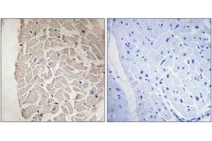 Immunohistochemistry analysis of paraffin-embedded human heart tissue, using Collagen VI alpha1 Antibody. (COL6A1 anticorps  (AA 191-240))