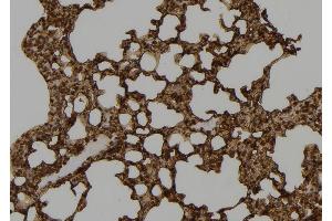 ABIN6277493 at 1/100 staining Mouse lung tissue by IHC-P. (SETD8 anticorps  (Internal Region))