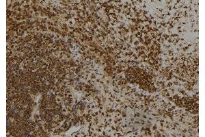 ABIN6266445 at 1/100 staining Human spleen tissue by IHC-P. (CAPG anticorps  (Internal Region))