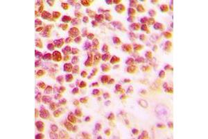 Immunohistochemical analysis of c-Myb staining in human tonsil formalin fixed paraffin embedded tissue section.