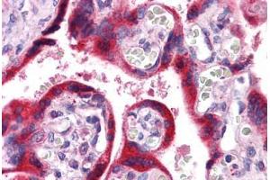 Human Placenta: Formalin-Fixed, Paraffin-Embedded (FFPE)