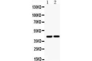 Anti- RUNX3 antibody, Western blotting All lanes: Anti RUNX3  at 0. (RUNX3 anticorps  (Middle Region))