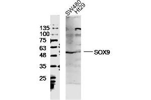 SW480 and Ht29 lysates probed with SOX9 Polyclonal Antibody, unconjugated  at 1:300 overnight at 4°C followed by a conjugated secondary antibody at 1:10000 for 90 minutes at 37°C. (SOX9 anticorps  (AA 121-220))