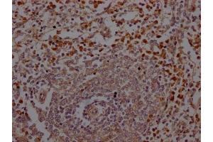 IHC image of ABIN7127640 diluted at 1:100 and staining in paraffin-embedded human spleen tissue performed on a Leica BondTM system.