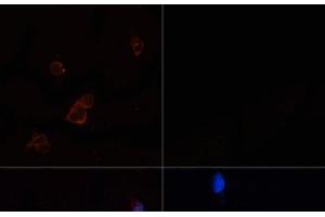 Immunofluorescence analysis of 293T cells using ACACA Polyclonal Antibody at dilution of 1:100.