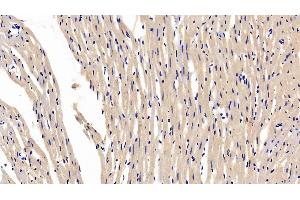 Detection of ITLN1 in Rat Cardiac Muscle Tissue using Polyclonal Antibody to Intelectin 1 (ITLN1)