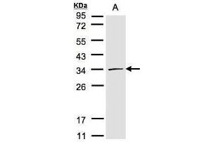 WB Image Sample(30 μg of whole cell lysate) A:293T 12% SDS PAGE antibody diluted at 1:1000 (CDK4 anticorps)