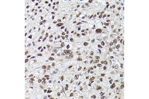 Immunohistochemistry of paraffin-embedded Human lung using SRSF2 antibody (ABIN1682677, ABIN3017915, ABIN3017916, ABIN5664377 and ABIN6220303) at dilution of 1:100 (40x lens). (SRSF2 anticorps  (AA 1-75))
