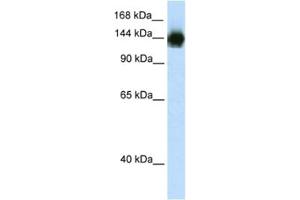 Western Blotting (WB) image for anti-Timeless Homolog (TIMELESS) antibody (ABIN2461712) (TIMELESS anticorps)