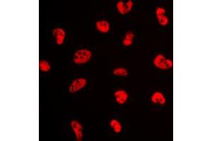 Immunofluorescent analysis of Estrogen Receptor alpha (pS106) staining in MCF7 cells. (Estrogen Receptor alpha anticorps  (pSer106))