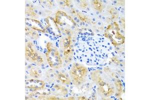 Immunohistochemistry of paraffin-embedded mouse kidney using MOK antibody (ABIN3022550, ABIN3022551, ABIN3022552 and ABIN6218895) at dilution of 1:100 (40x lens).
