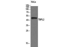 Western Blotting (WB) image for anti-TATA Box Binding Protein Like 2 (Tbpl2) (Internal Region) antibody (ABIN3177636) (Tbpl2 anticorps  (Internal Region))
