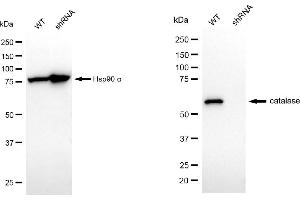 Western blotting analysis using catalase antibody (ABIN7797919).