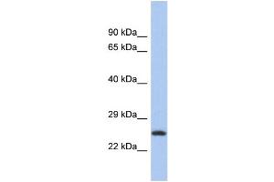 Western Blotting (WB) image for anti-Chromosome 9 Open Reading Frame 173 (C9ORF173) (N-Term) antibody (ABIN2786549) (C9ORF173 anticorps  (N-Term))