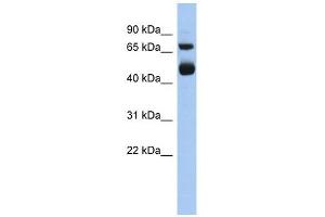ALOX15 antibody used at 1 ug/ml to detect target protein. (ALOX15 anticorps  (Middle Region))