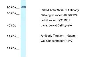 Western Blotting (WB) image for anti-RAS Protein Activator Like 1 (GAP1 Like) (RASAL1) (C-Term) antibody (ABIN2789073) (RASAL1 anticorps  (C-Term))