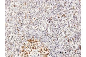 Immunoperoxidase of purified MaxPab antibody to MCM6 on formalin-fixed paraffin-embedded human lymph node.
