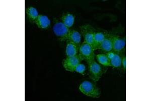 IF analysis of CD59 using anti-CD59 antibody (ABIN3043396). (CD59 anticorps  (AA 26-102))