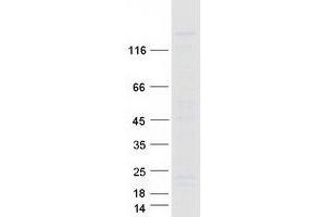 Validation with Western Blot