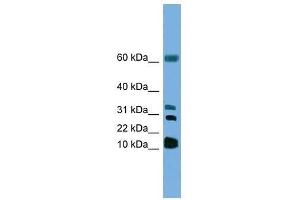 Western Blot showing LTC4S antibody used at a concentration of 1. (LTC4S anticorps  (N-Term))