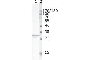 Western Blot testing of HIV-1 recombinant Nef protein. (HIV-1 Nef (AA 150-158) anticorps)
