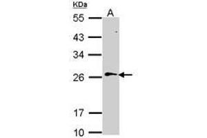 Image no. 2 for anti-RAN, Member RAS Oncogene Family (RAN) (AA 1-179) antibody (ABIN467626) (RAN anticorps  (AA 1-179))
