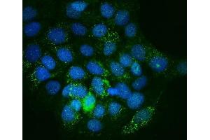 IF analysis of Integrin linked ILK using anti-Integrin linked ILK antibody (ABIN7602632).