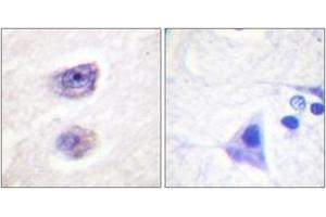 Immunohistochemistry analysis of paraffin-embedded human brain, using Tyrosine Hydroxylase (Phospho-Ser8) Antibody.