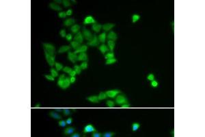 Immunofluorescence analysis of U2OS cells using PJA2 Polyclonal Antibody (PJA2 anticorps)